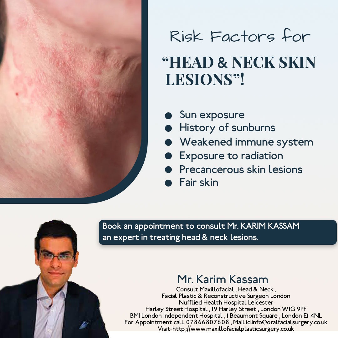 Skin lesions on the head and neck are more likely to occur on skin that has been burned, sunburned, or affected by illness.

click here- maxillofacialplasticsurgery.co.uk

#mrkarimkassamfrcs #headneck #skinlessions #london #leicester