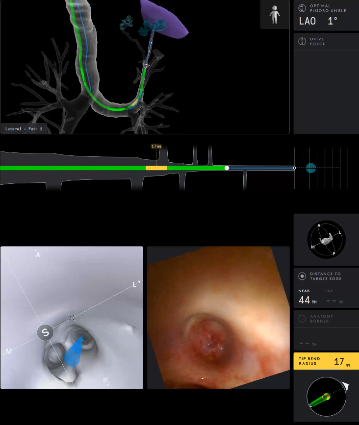 Ramsy Abdelghani, MD tweet media