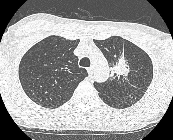 Ramsy Abdelghani, MD tweet media