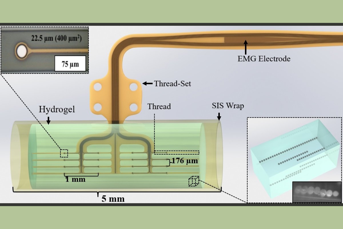 .<a href="/UF/">FLORIDA</a> neuroscientists &amp; biomedical engineers report findings of rat-model study suggesting novel implantable device MARTEENI shows promise to potentially improve function &amp; movement of prosthetic devices designed to work with peripheral nerves.

Read more: bit.ly/3pZTRq0