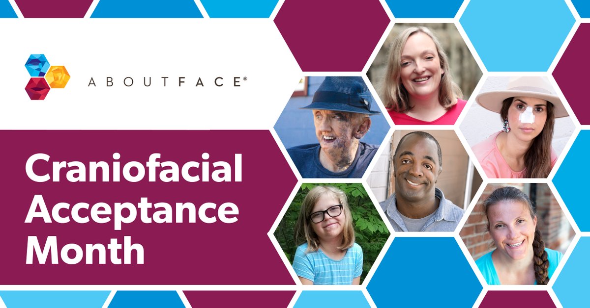 aboutface's tweet image. Welcome to Craniofacial Acceptance Month! We have a lot of engaging events planned this month to recognize and advocate for people in the facial difference community. Make sure to follow along! #CraniofacialAcceptanceMonth #FacialDifferences