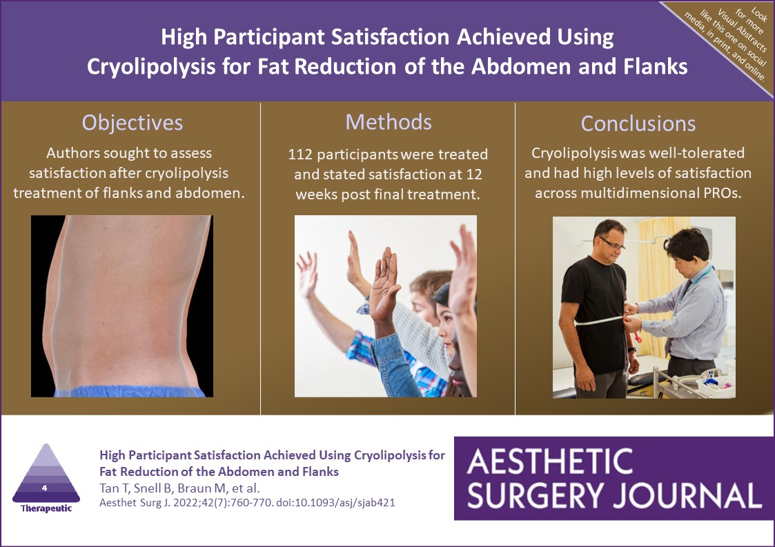 Aesthetic Surgery Journal/ASJ Open Forum (@asjrnl) on Twitter photo Can CoolSculpting on the flanks and/or abdomen provide satisfactory results for patients? Read here: bit.ly/3AJsCoq
@juliusfewmd
<a href="/NahaiDr/">Dr Nahai</a>
<a href="/drkenkel/">Jeffrey Kenkel, MD</a>
<a href="/TheAestheticSoc/">The Aesthetic Society</a>
<a href="/drroykim/">Roy Kim 🇺🇸</a> Can CoolSculpting on the flanks and/or abdomen provide satisfactory results for patients? Read here: bit.ly/3AJsCoq
@juliusfewmd
<a href="/NahaiDr/">Dr Nahai</a>
<a href="/drkenkel/">Jeffrey Kenkel, MD</a>
<a href="/TheAestheticSoc/">The Aesthetic Society</a>
<a href="/drroykim/">Roy Kim 🇺🇸</a>