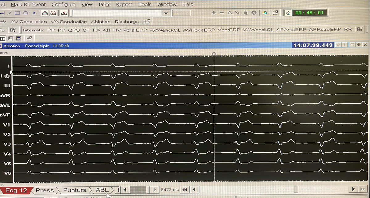 Luca Segreti tweet media