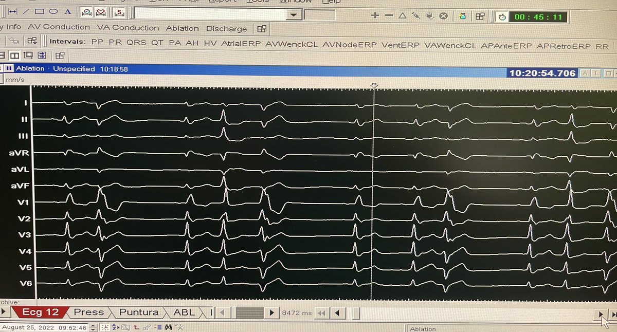 Luca Segreti tweet media