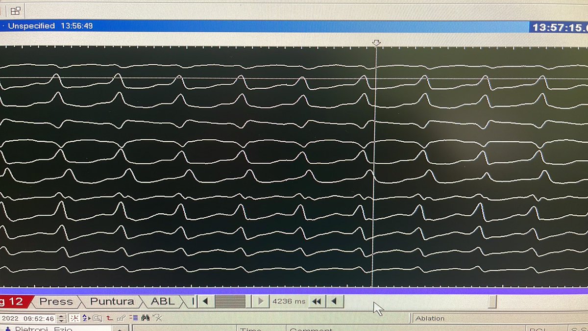 Luca Segreti tweet media