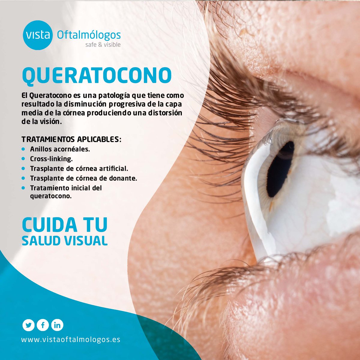 grupo_vista's tweet photo. El #Queratocono tiene como resultado la disminución progresiva de la capa media de la #Córnea produciendo una #DistorsiónDeLaVisión. En @grupo_vista disponemos de la tecnología más avanzada para solucionar cualquier patología ocular.
🔹 Pide tu cita: https://t.co/uOHwZ70yJw https://t.co/1Kr49cdGRS
