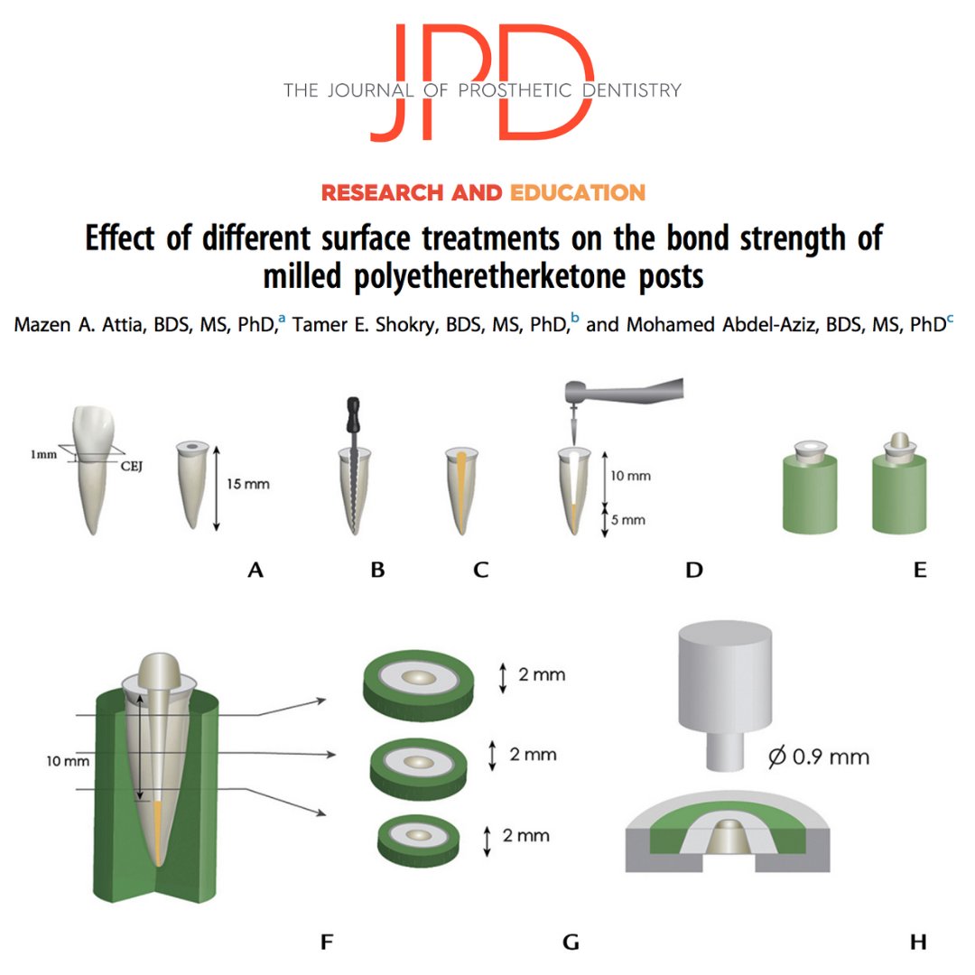 JPDentistry's tweet photo. This #invitrostudy from #theJPD evaluated the effect of sulfuric acid etching, airborne-particle abrasion, and nonthermal plasma treatments on the push-out bond strength of milled #polyetheretherketone (#PEEK) posts to resin cement. Learn more: https://t.co/UocrajB94y https://t.co/f06eiMGDjj