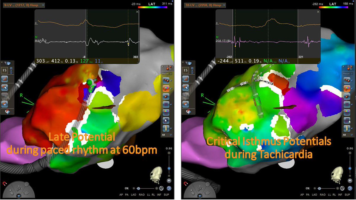 Luca Segreti tweet media