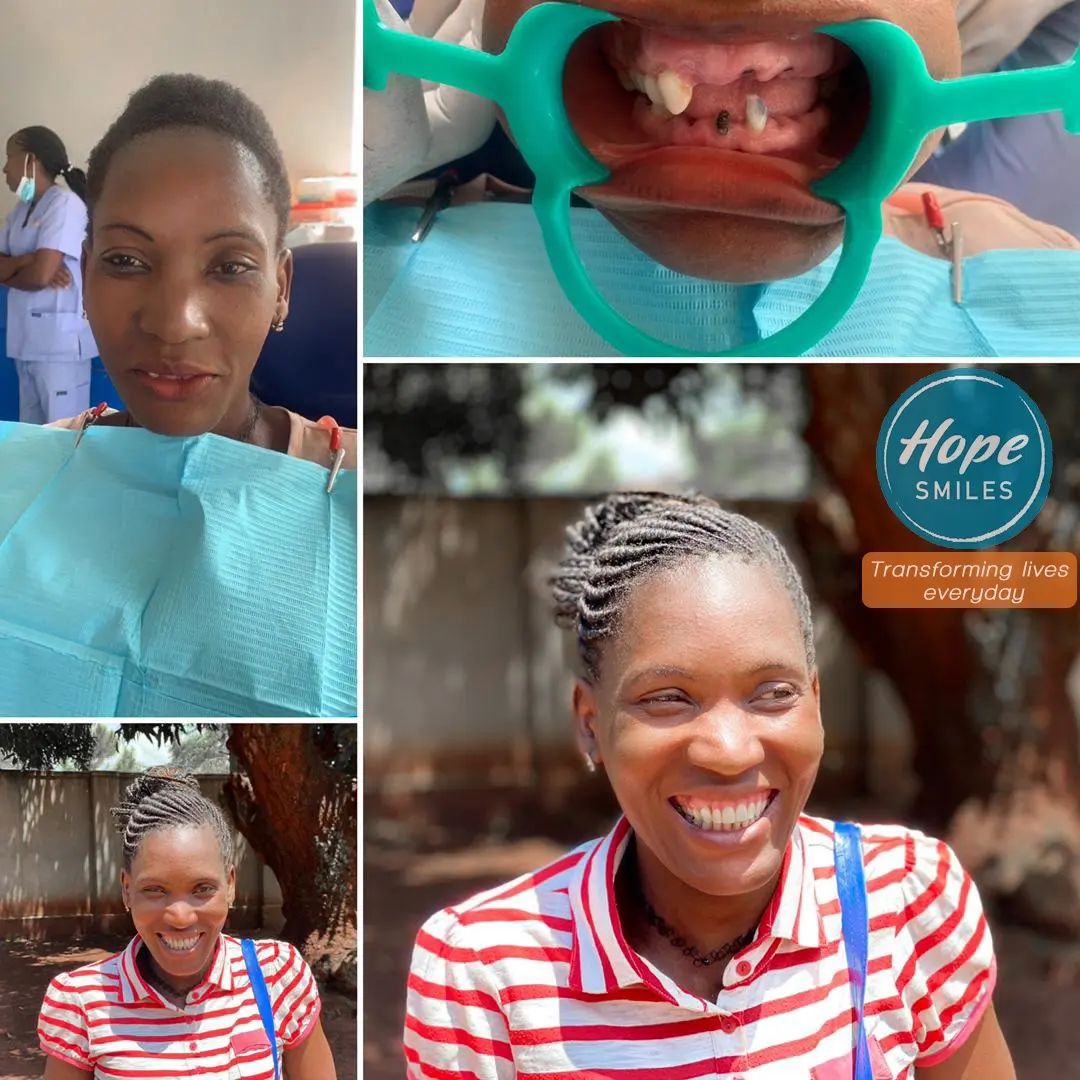 Each Hope Smiles team member around the world works to bring transformative hope through dentistry!

You can too!

Join us in Tennessee or Uganda! Learn more at hopesmiles.org

#hopesmiles #dentistry #hope
