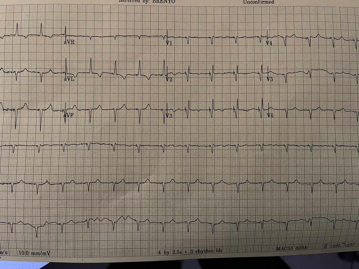 Lbb pacing case today. Love this stuff. #epeeps
