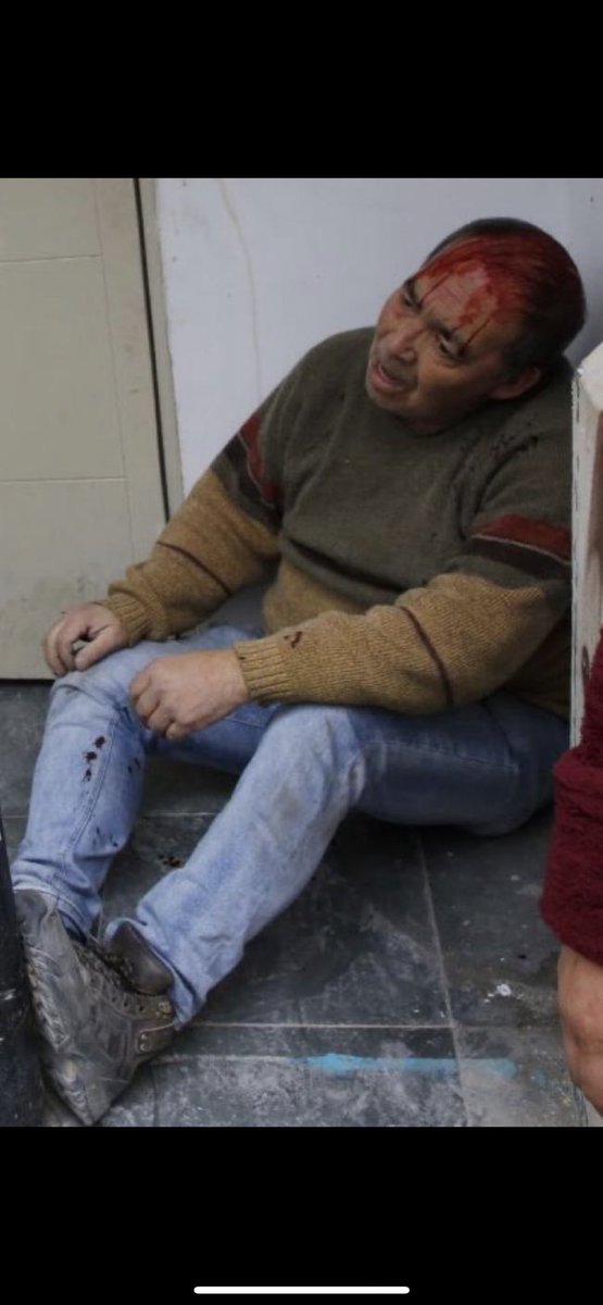 nesis_b's tweet photo. @Cami_FloresO Y que pasa con este señor que también fue agredido ?? No es importante ? https://t.co/dMZJnrxmlu