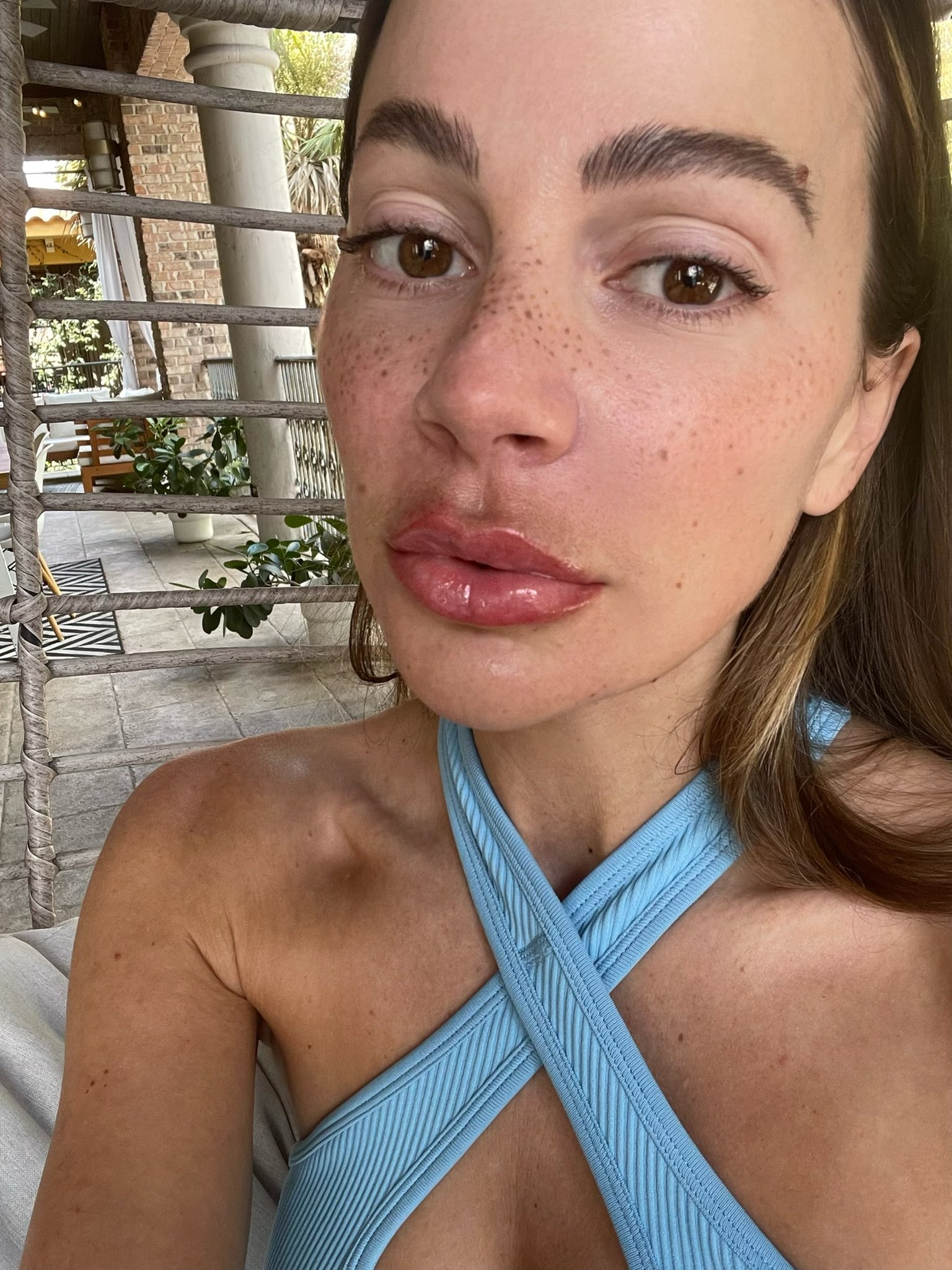 Abigail Mac on Twitter: "Just got my lips done 👄 I LOVE THEM 🥰 ️ https://t.co/Y7dSZ9DP9t" / Twitter