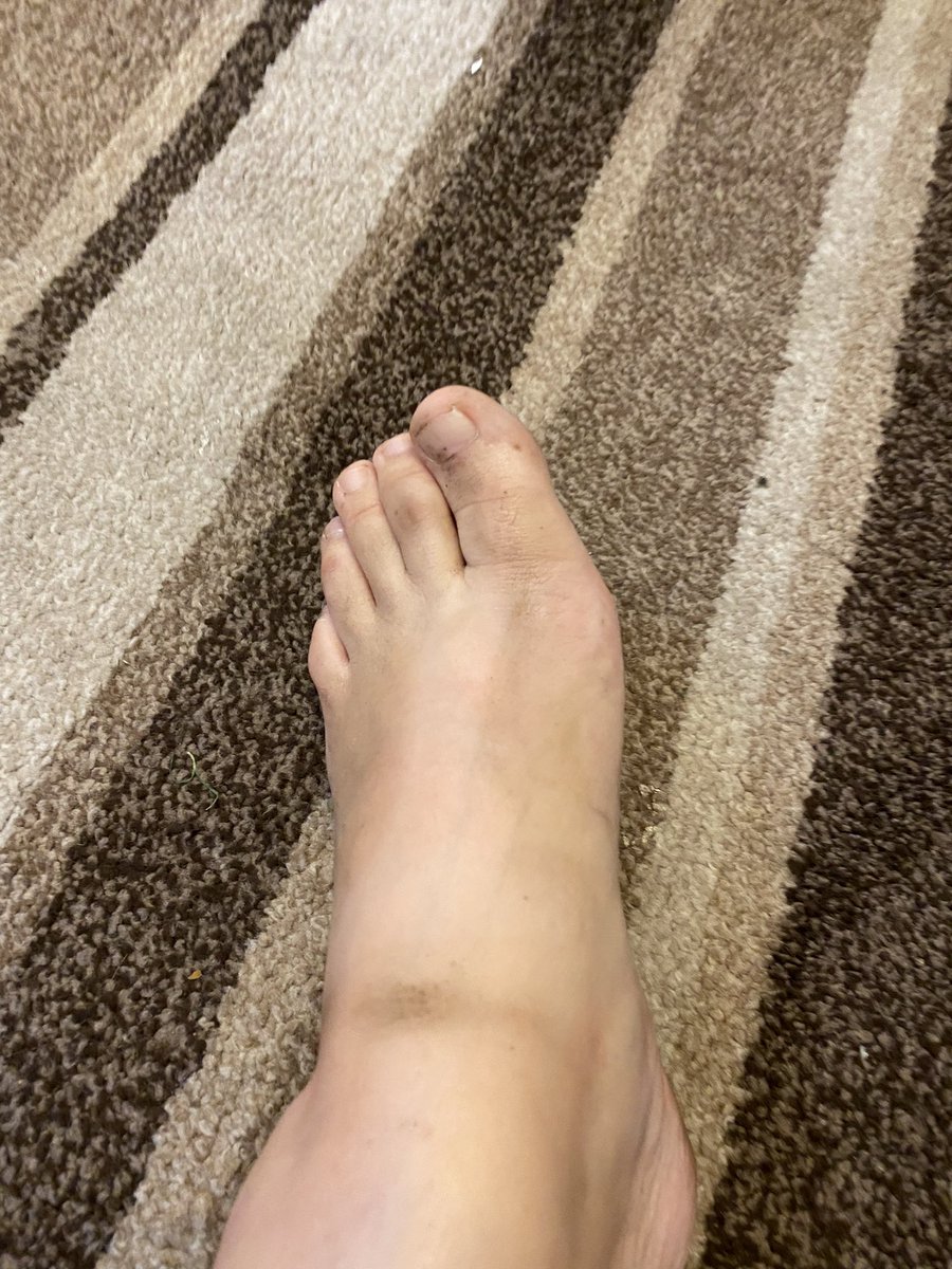 sublittlegurl's tweet photo. Flip flops on all day and now my feet are, filthy, disgusting and muddy. Lovely and sweaty. #sweatyfeet #smellyfeet #feetfinder #feet #feetfethish #flipflops #thongs #disgustingfeet #muddyfeet #cashpay #feetpay #pigpay https://t.co/ehKgDwUIqw