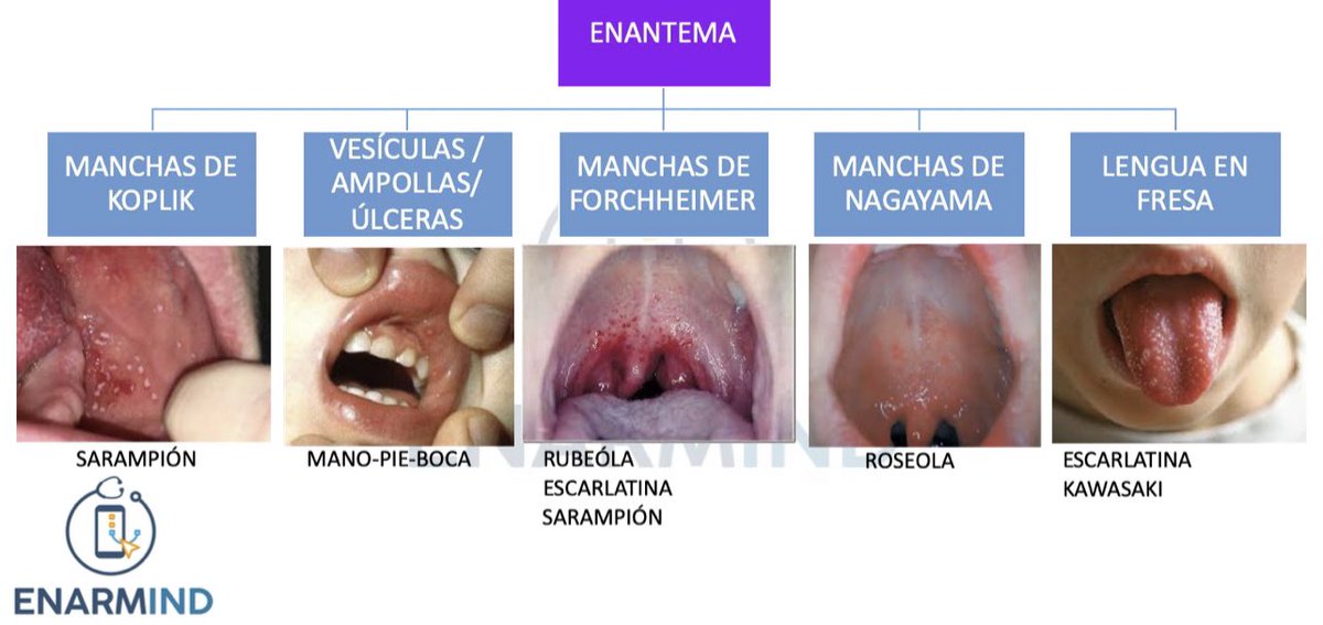 ENARMcraks's tweet photo. Exantema #ENARMIND https://t.co/TRgynrSf6Q
