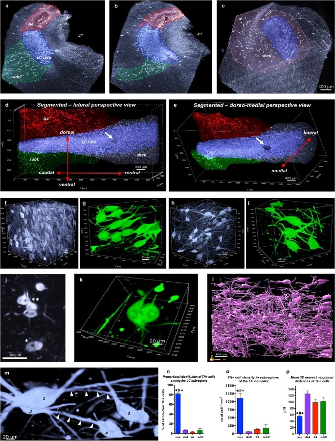 I bet you have never seem a 3D reconstruction of human locus ceruleus @ microscopic resolution. Check out Csaba Adori's  latest work and see what happen in #Alzheimer rdcu.be/cUNn2 #nsspia @HeidiJacobsLab @NSS_PIA @GrinbergLab @DrNeuroChic @LCneuroscience @ajehrenberg