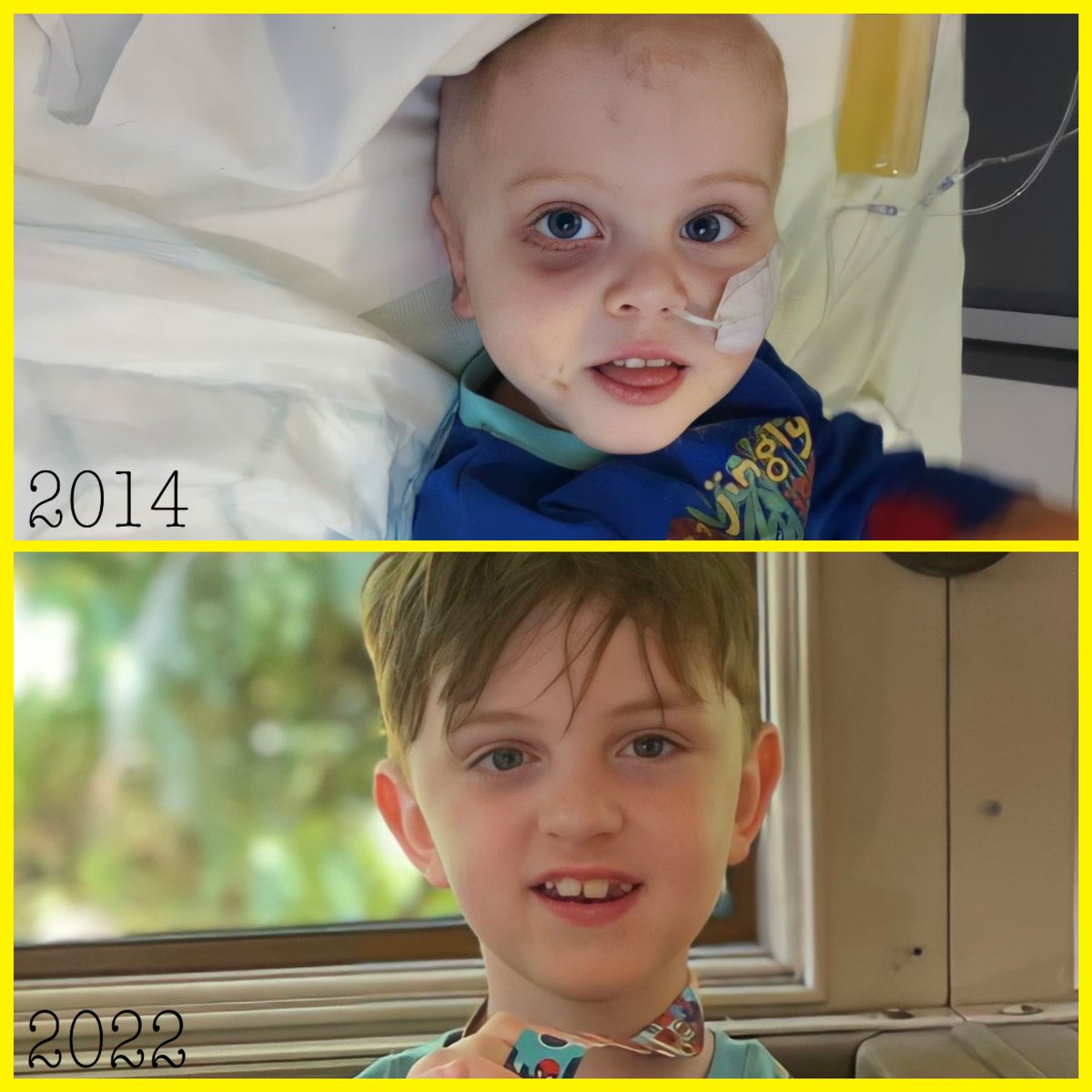 these two pictures are the same child. my beautiful boy. 2014 fighting a very aggressive childhood cancer Neuroblastoma still smiling. 2022 survivor of childhood cancer smiling on holiday. i will never forget how lucky we are &amp; i count our blessings 💛 #CCAM #Neuroblastoma