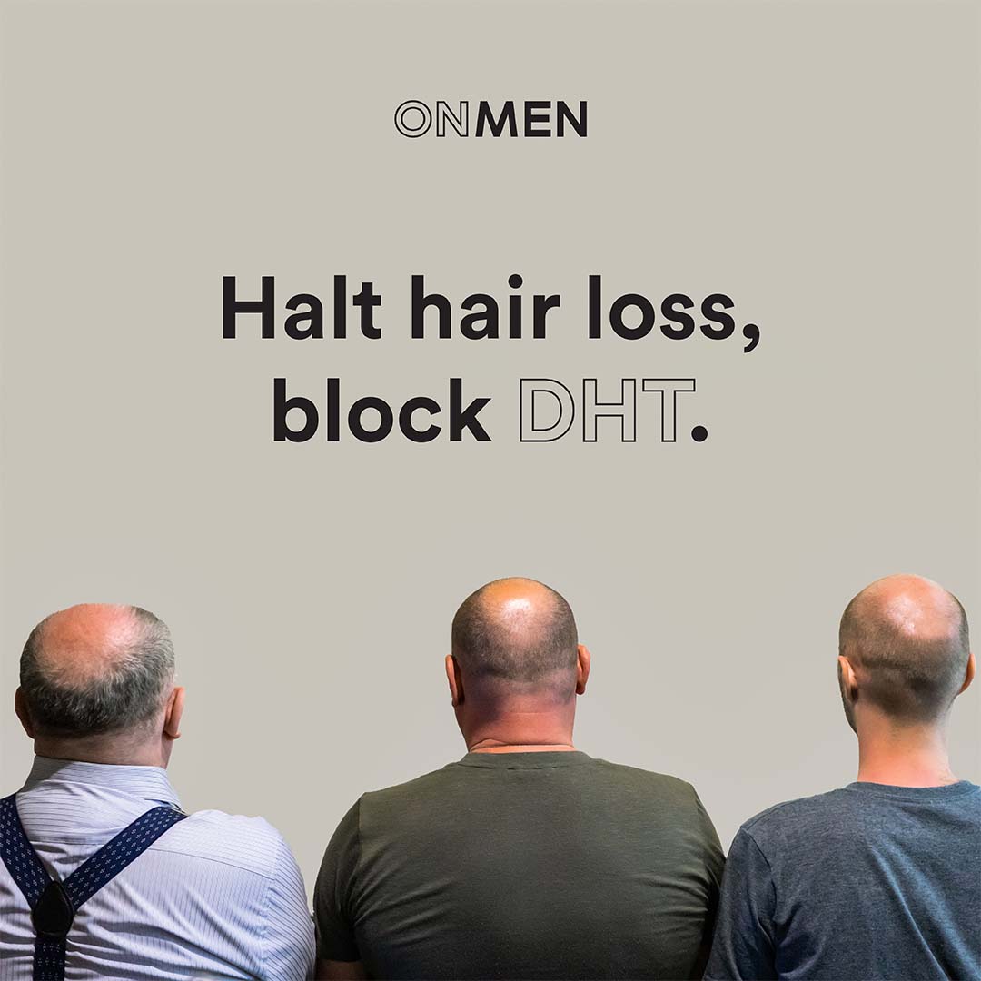 onmen_ca's tweet photo. Does male pattern #baldness run in your family? Well, it doesn’t have to be your reality! OnMen’s custom compounded Minoxidil &amp; Finasteride solution stimulates hair follicles for production of new hair, &amp; arrests the shedding of existing strands, for an increased volume of hair ! https://t.co/c3kffzAm0B
