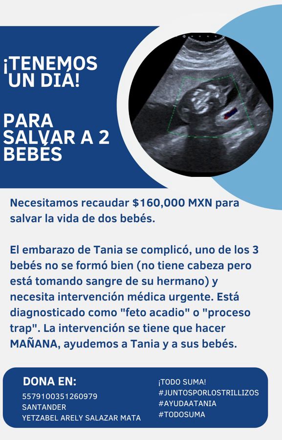 ¡Tenemos un Día para salvar 2 vidas! 

#AyudaATania 

Comparte y dona