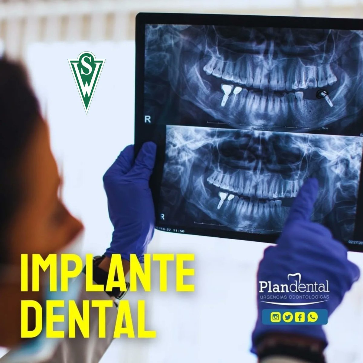 ZonaVerdeSW's tweet photo. LA CLÍNICA VERDE!

Clínica Plan Dental nos recibe en Valparaíso para cuidar tus dientes y podamos seguir sonriendo en septiembre.

- Blanqueamiento dental

- Implante dental

- Dientes alineados

Son algunos servicios. Agenda en el teléfono (32) 2592038 🦷🇳🇬

#Historiade130años https://t.co/dMAJbdEN32