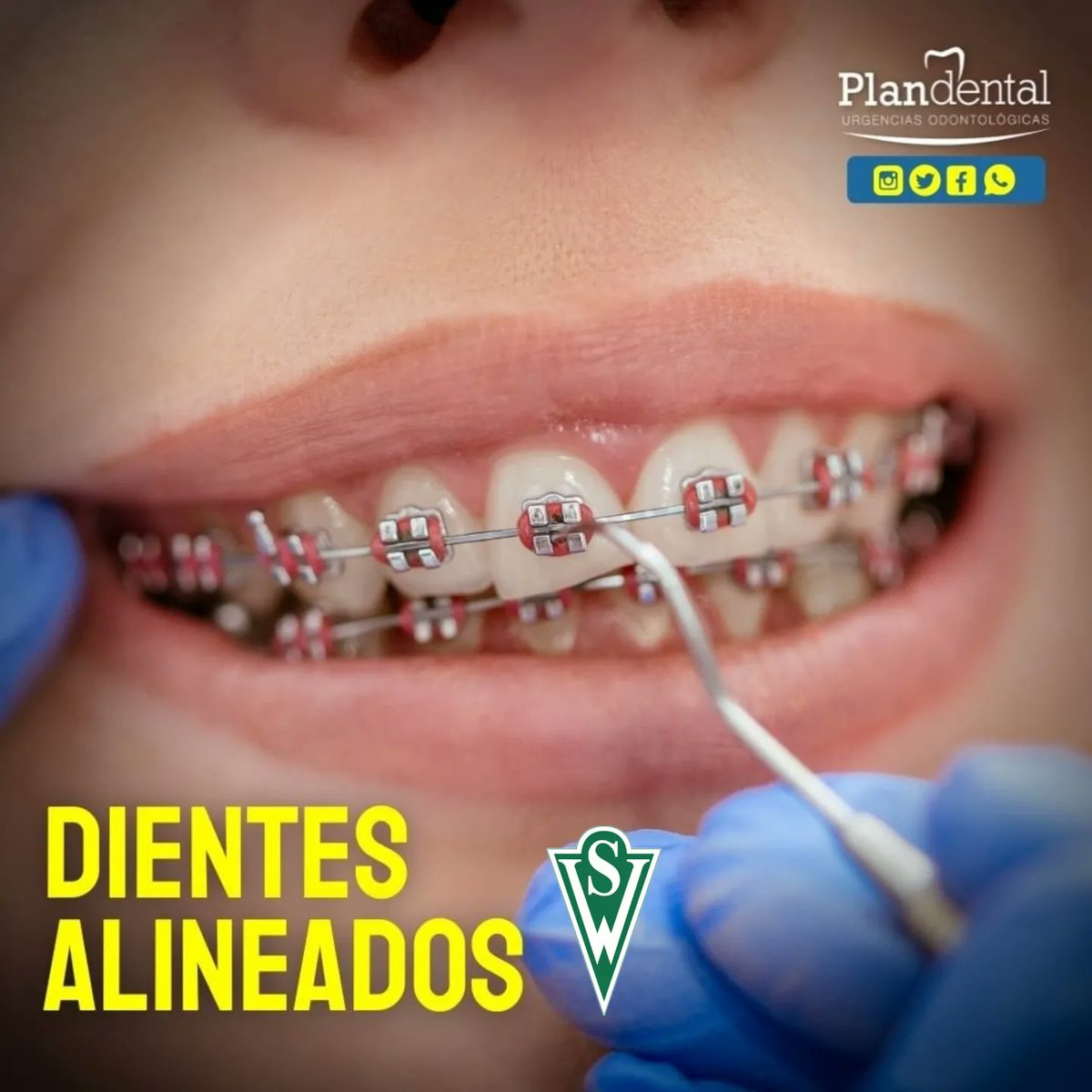 ZonaVerdeSW's tweet photo. LA CLÍNICA VERDE!

Clínica Plan Dental nos recibe en Valparaíso para cuidar tus dientes y podamos seguir sonriendo en septiembre.

- Blanqueamiento dental

- Implante dental

- Dientes alineados

Son algunos servicios. Agenda en el teléfono (32) 2592038 🦷🇳🇬

#Historiade130años https://t.co/dMAJbdEN32
