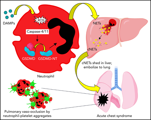 Prithu Sundd (@prithusundd) on Twitter photo Thanks to @BloodJournal for selecting our new study as the cover article for the latest issue.
Liver-to-lung microembolic NETs promote gasdermin D–dependent inflammatory lung injury in sickle cell disease. doi.org/10.1182/blood.….
Thanks <a href="/SunddLab/">Sundd Lab @ Versiti Blood Research Institute</a> and coauthors <a href="/ASH_hematology/">ASH</a> Thanks to @BloodJournal for selecting our new study as the cover article for the latest issue.
Liver-to-lung microembolic NETs promote gasdermin D–dependent inflammatory lung injury in sickle cell disease. doi.org/10.1182/blood.….
Thanks <a href="/SunddLab/">Sundd Lab @ Versiti Blood Research Institute</a> and coauthors <a href="/ASH_hematology/">ASH</a>