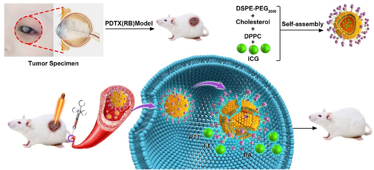 ActaPharmSinB's tweet photo. Article✍️#Liposome-based #multifunctional #nanoplatform as effective therapeutics for the treatment of #retinoblastoma. ICG-loaded liposomes can be used for fluorescence and photoacoustic image-guided #photothermal treatment of retinoblastoma.
https://t.co/I4XTuN0XHV https://t.co/A1PgfgQdeZ