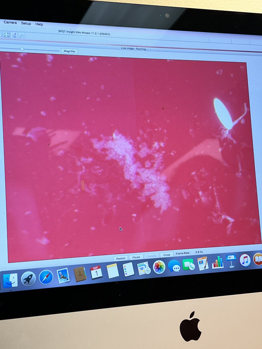 areyoukeddingme's tweet photo. Had some fun learning about tick dissections from all-around tick and lab guru, Sara! 🤩

Did you know tick salivary glands look like #forbiddengrapes 🍇 and that tick ovaries looks like a long #forbiddennoodle 🍝? Well now you do. Thanks for coming to my #TickTok! 🙃 https://t.co/XXu4kdY4iZ