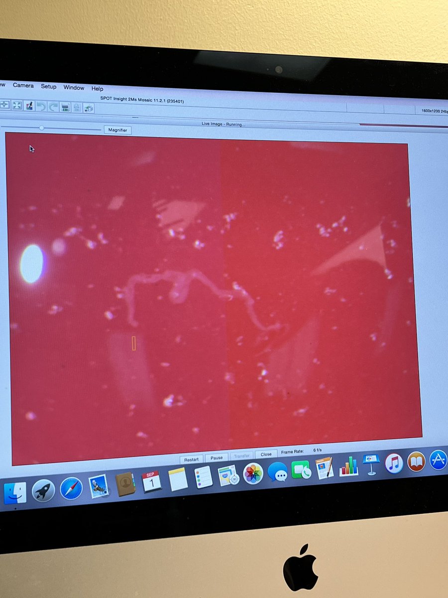 areyoukeddingme's tweet photo. Had some fun learning about tick dissections from all-around tick and lab guru, Sara! 🤩

Did you know tick salivary glands look like #forbiddengrapes 🍇 and that tick ovaries looks like a long #forbiddennoodle 🍝? Well now you do. Thanks for coming to my #TickTok! 🙃 https://t.co/XXu4kdY4iZ