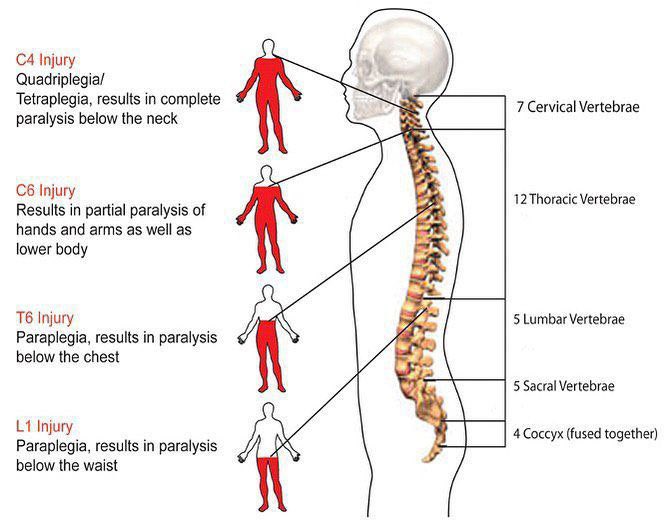 September is Spinal Cord Injury Awareness Month. Researchers estimate there are approximately 17,000 spinal cord injuries each year. We want to take this opportunity to spread awareness.
1/30

#SCIAwareness #spinalcordinjury