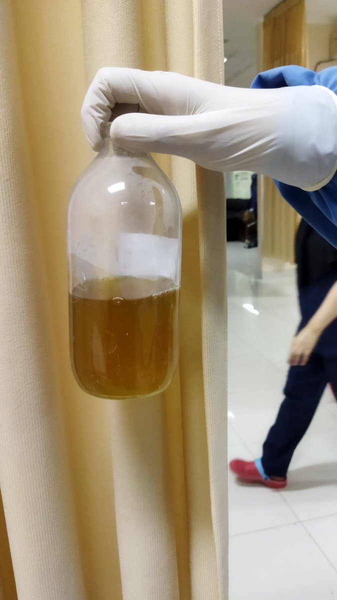 <a href="/detikcom/">detikcom</a> Ini hasil sedot cairan di paru paru kiri dan ttp lanjut karna paru paru nanti tidak smile klo ngga ngevape