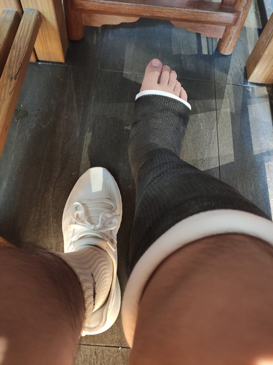 Castbo951106's tweet photo. SLC
#cast #slc #leg #legcast https://t.co/7PJeDf42NO