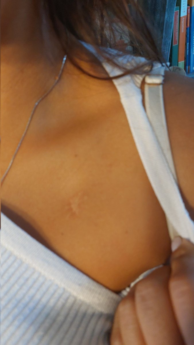 Esta cicatriz es de cuando me clavaron un cuchillo p robarme
A mi hna la violaron 2 tipos, a otra le dispararon en la cabeza y como la bala no salió se la abrieron de 1 culetazo
No tuvimos Justicia ni Feriado
Cuenten uds los q les tocó vivir👇
(Tal vez <a href="/alferdez/">Alberto Fernández</a> se solidariza 🤡)