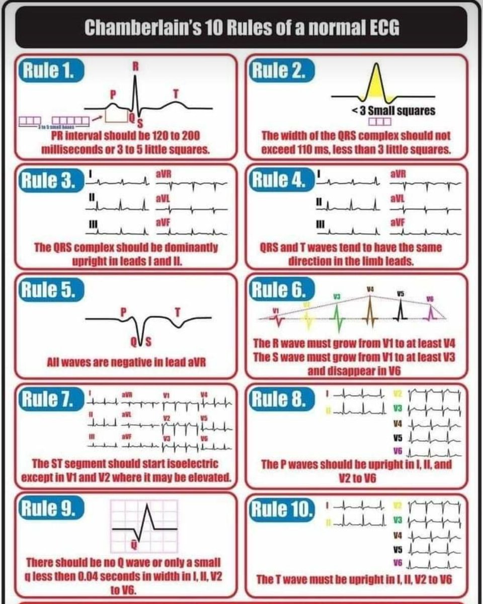 zeshanrafaqat's tweet photo. Chamberlain's 10 Rules of a Normal ECG
#medical #medicalschool #mbbs #mbbsstudent #chestpain #emergency #emergencymedicine #ecg #ecginterpretation #normalecg #medicaltalkss #drzeeshanrafaqat https://t.co/gJECTMdCcE