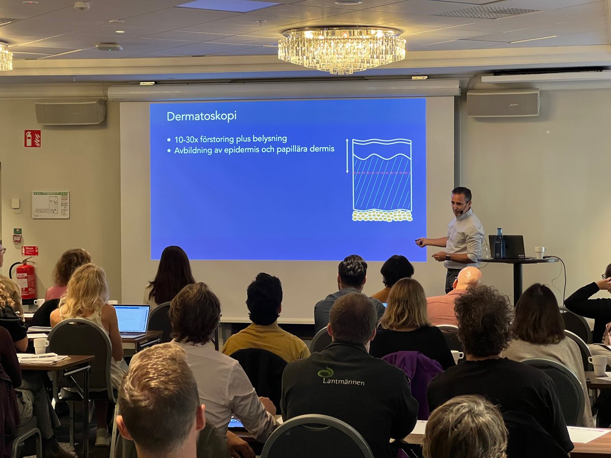 John Paoli igång med dagens dermatoskopikurs i Göteborg - så kul! Första tipset: använd kontaktdermatoskopi med polariserat ljus och rikligt med gel för att se bra. <a href="/PaoliJohn/">John Paoli</a>