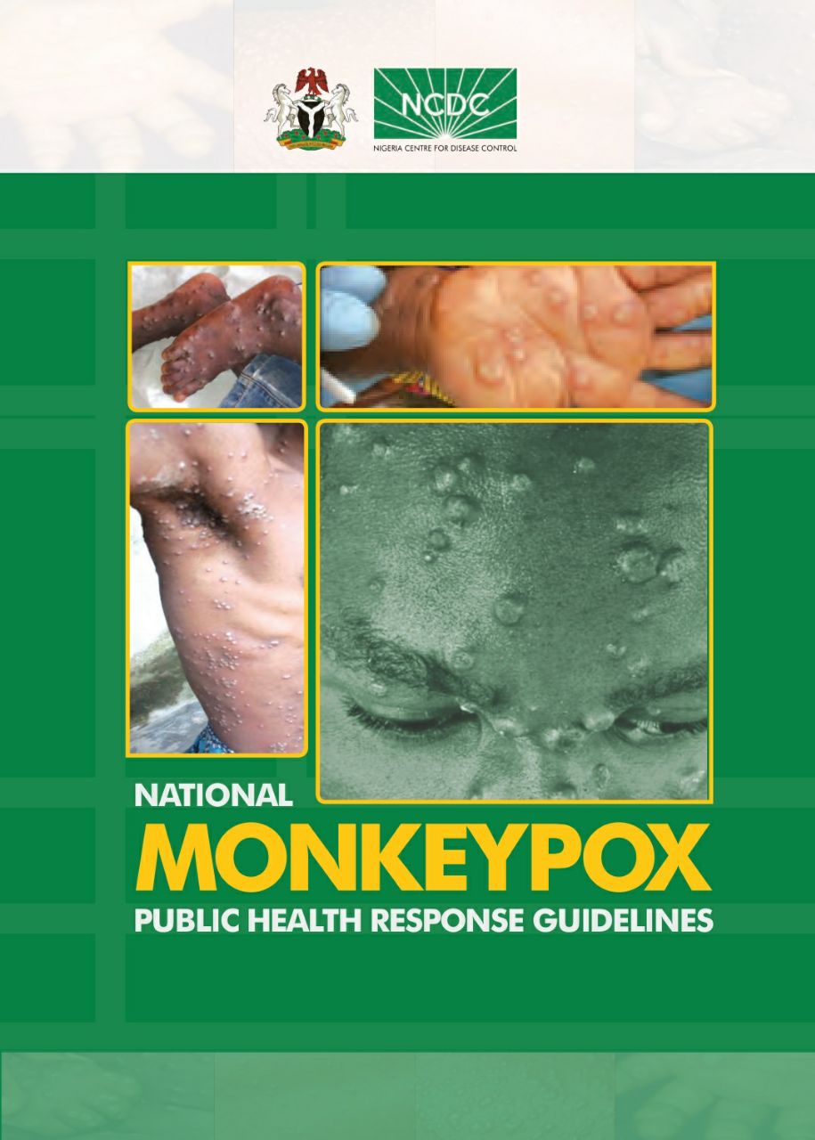 NCDC on Twitter "In 2019, we developed a national Monkeypox guideline