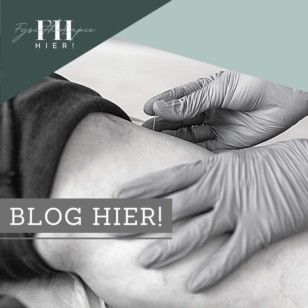 HierFysio's tweet photo. BLOG: DRY NEEDLING ‘De Westerse manier van accupunctuur’

De laatste jaren hoor je vaak de term dry needling voorbij komen. Dit wordt door steeds meer fysiotherapeuten toegepast zo ook bij HIER! in Steenwijk...... 

Lees het volledige blog verder op: https://t.co/ZZJ4aICqDO https://t.co/rehgko7rvh