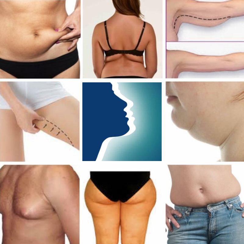 SereneAmanda's tweet photo. Are you considering fat dissolving treatment?

This treatment specifically targets stubborn pockets of fat resistant to exercise:
Double chin ☑️ Jowls ☑️ Jawline ☑️ Arms ☑️ Abdomen ☑️ Thighs ☑️ Hips

☎️ Phone/message: 07444938248
💻 https://t.co/qvCVh60Ntu https://t.co/YHGlbJITCR