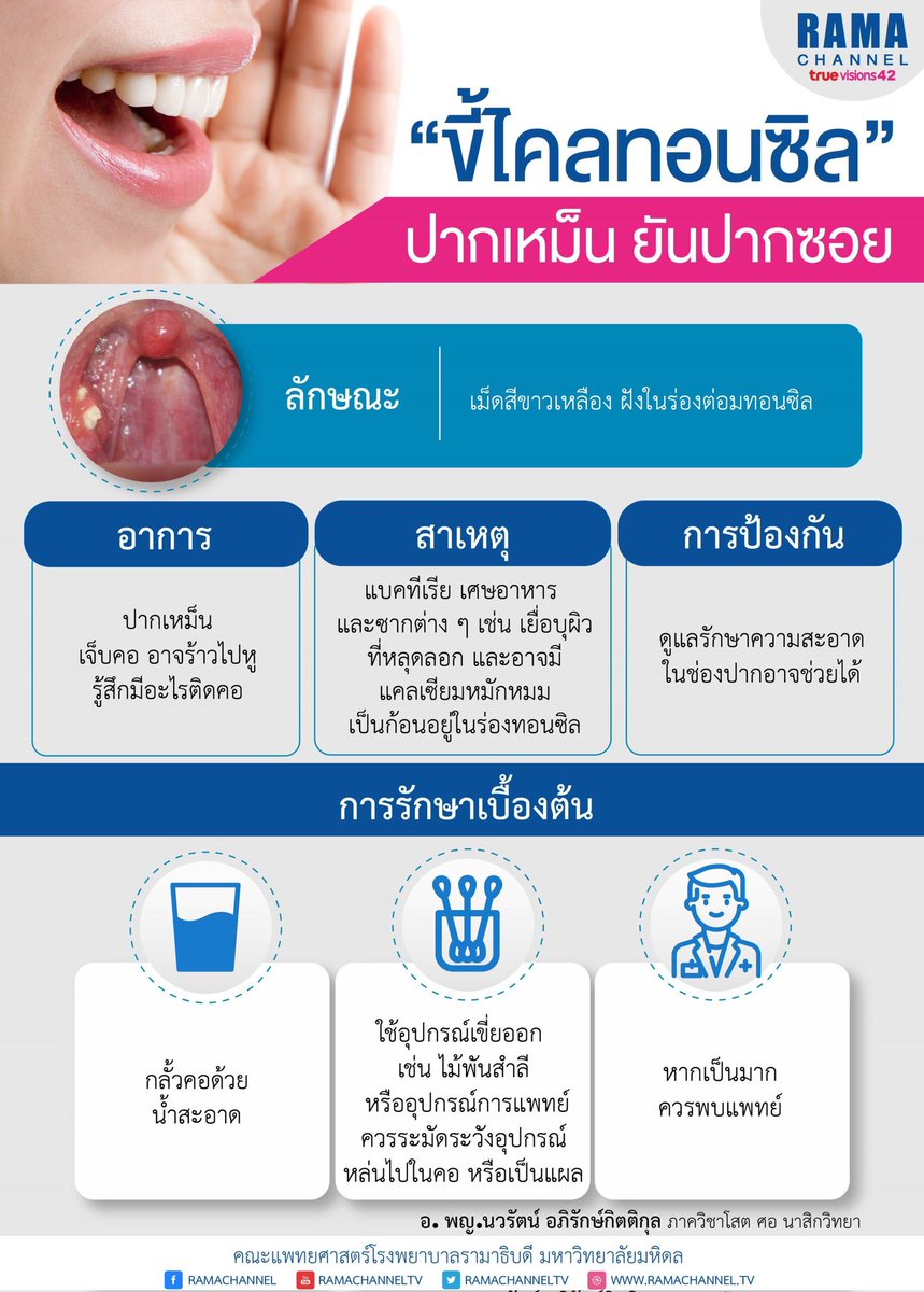 ApirakNavarat's tweet photo. #ขี้ไคลทอนซิล #นิ่วต่อมทอนซิล #tonsillolith #tonsilstone #ปากเหม็น #ทอนซิล อาจารย์แพทย์ พญ. นวรัตน์  อภิรักษ์กิตติกุล 
#อาจารย์แพทย์ #หูคอจมูก #รามาธิบดี #นวรัตน์ #อภิรักษ์กิตติกุล #นวรัตน์อภิรักษ์กิตติกุล #ENT #โสตศอนาสิก #ขี้ไคลทอนซิลปากเหม็นยันปากซอย #โปสเตอร์ #หมอรามา https://t.co/VQ4oRIDrGP