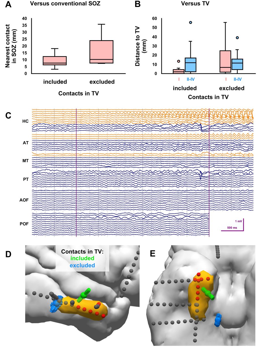 ClinicalNeuroph's tweet photo. [Ictal SEEG and seizure outcome] Satzer et al.: "Ictal SEEG source localization is useful in corroborating the epileptogenic zone, assuming near-field recordings are obtained."

https://t.co/p72CAUHF4G

https://t.co/LzHAzeGMZ5
#ICCN2022 https://t.co/ZHphCNyfGD
