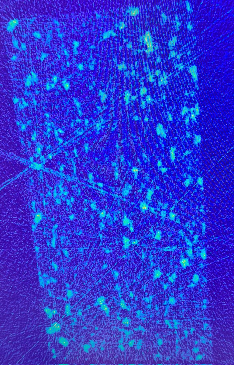 Iain Oswald💙 (@iainoswald) on Twitter photo First scans from <a href="/UniStrathclyde/">University of Strathclyde</a> collaboration with <a href="/FindenLtd/">Finden Ltd</a> <a href="/desy/">DESY (Deutsch)</a>....exciting times! With <a href="/julia_gasol/">Julia Gasol Cardona</a> <a href="/DanielMarkl/">Daniel Markl</a> <a href="/ccdc_cambridge/">CCDC Cambridge</a> @EPSRC_CMAC <a href="/SIPBS_Strath/">StrathPharm&Bio</a> First scans from <a href="/UniStrathclyde/">University of Strathclyde</a> collaboration with <a href="/FindenLtd/">Finden Ltd</a> <a href="/desy/">DESY (Deutsch)</a>....exciting times! With <a href="/julia_gasol/">Julia Gasol Cardona</a> <a href="/DanielMarkl/">Daniel Markl</a> <a href="/ccdc_cambridge/">CCDC Cambridge</a> @EPSRC_CMAC <a href="/SIPBS_Strath/">StrathPharm&Bio</a>