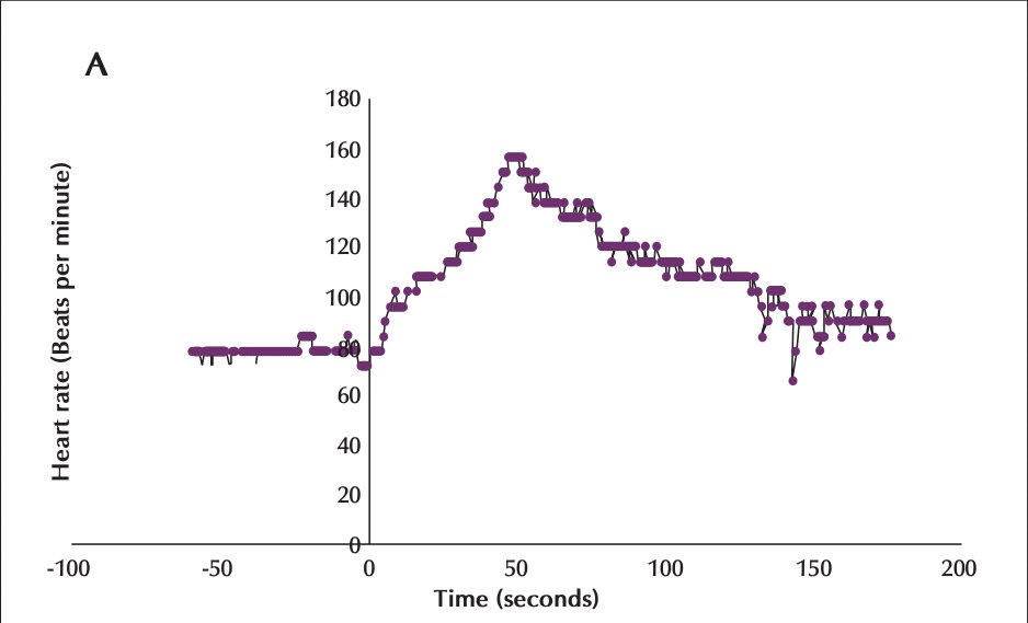 Epileptic Disorders tweet media