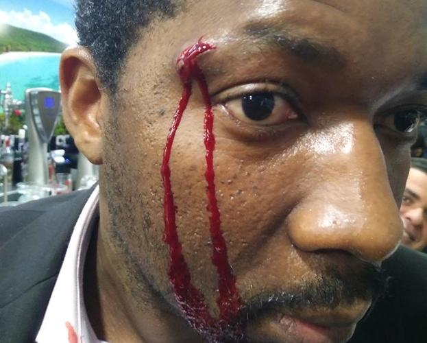 Santa_Padre's tweet photo. Durante esta madrugada fui brutalmente atacado por manifestantes del #Rechazo  

A pesar de los cortes y hematomas, lo que mas hiere fueron las palabras utilizadas en mi contra:

- ¿Por qué no te vas de mi país?
- Chile es de los blancos.
- Con Pinochet te abríamos matado, etc. https://t.co/V9MyE8P8P4