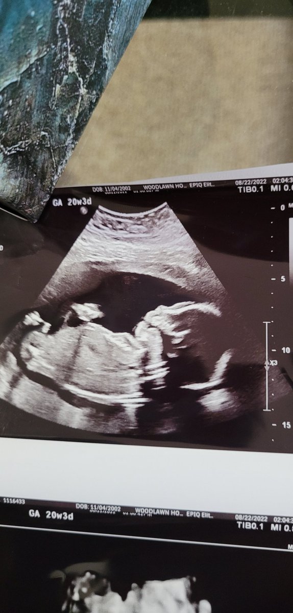 WildcatKing50's tweet photo. The World is bright for you Son. Coming Soon in January Damon Damani Woods Jr💙🤍 https://t.co/HSDUo4E3Jm