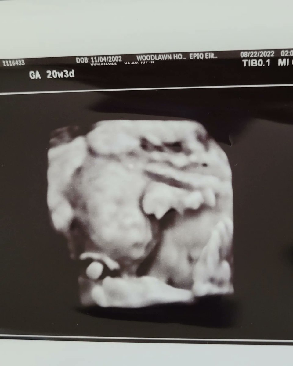 WildcatKing50's tweet photo. The World is bright for you Son. Coming Soon in January Damon Damani Woods Jr💙🤍 https://t.co/HSDUo4E3Jm