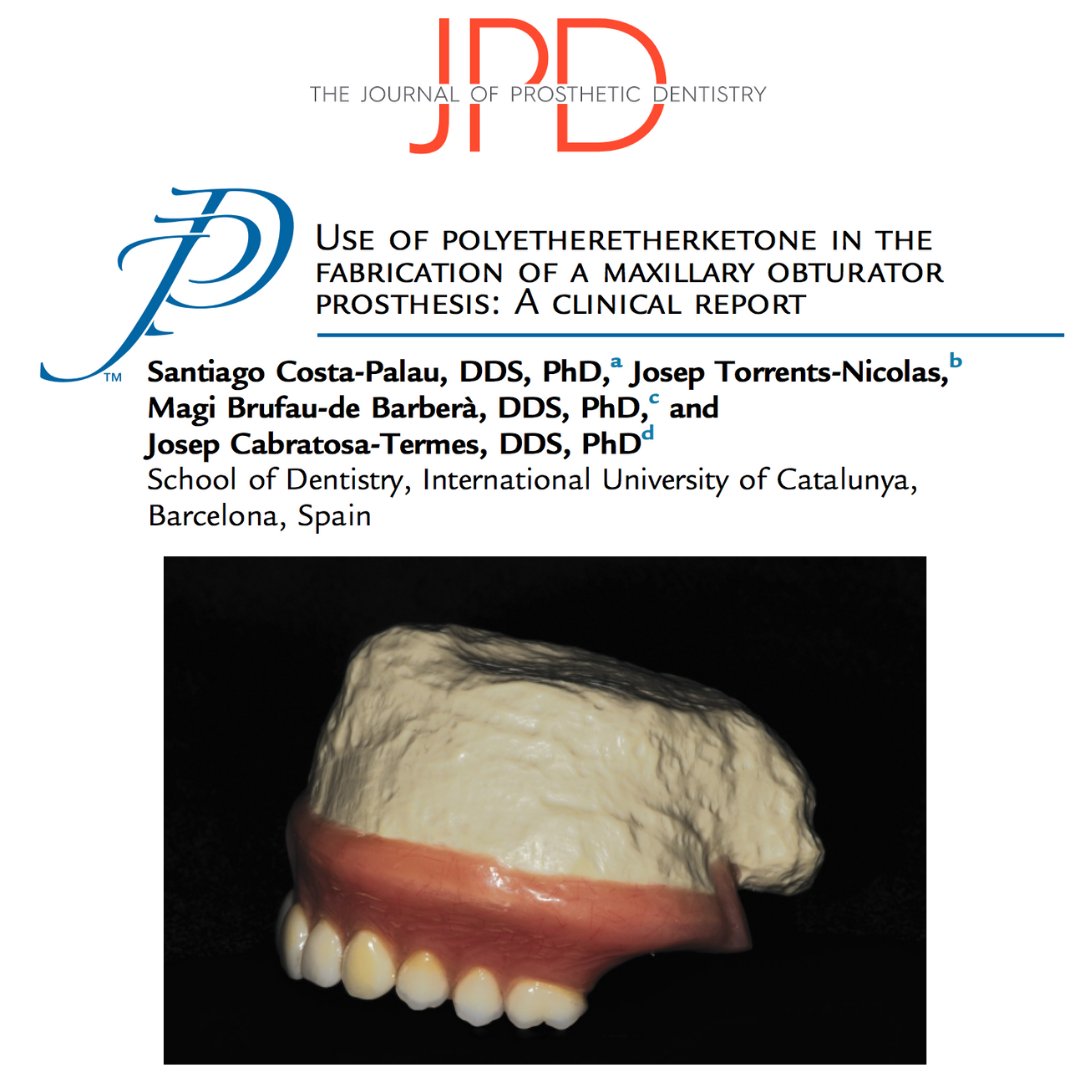 JPDentistry's tweet photo. In this #clinicalreport from #theJPD, a new #obturator was fabricated from #polyetheretherketone (#PEEK) to provide a better-adjusted, more functional, and lighter #oralprosthesis. Learn more: https://t.co/yIUU1m8tFF https://t.co/AqOthHhj9W