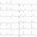 Photo by ECG Cases (@ecg_cases)