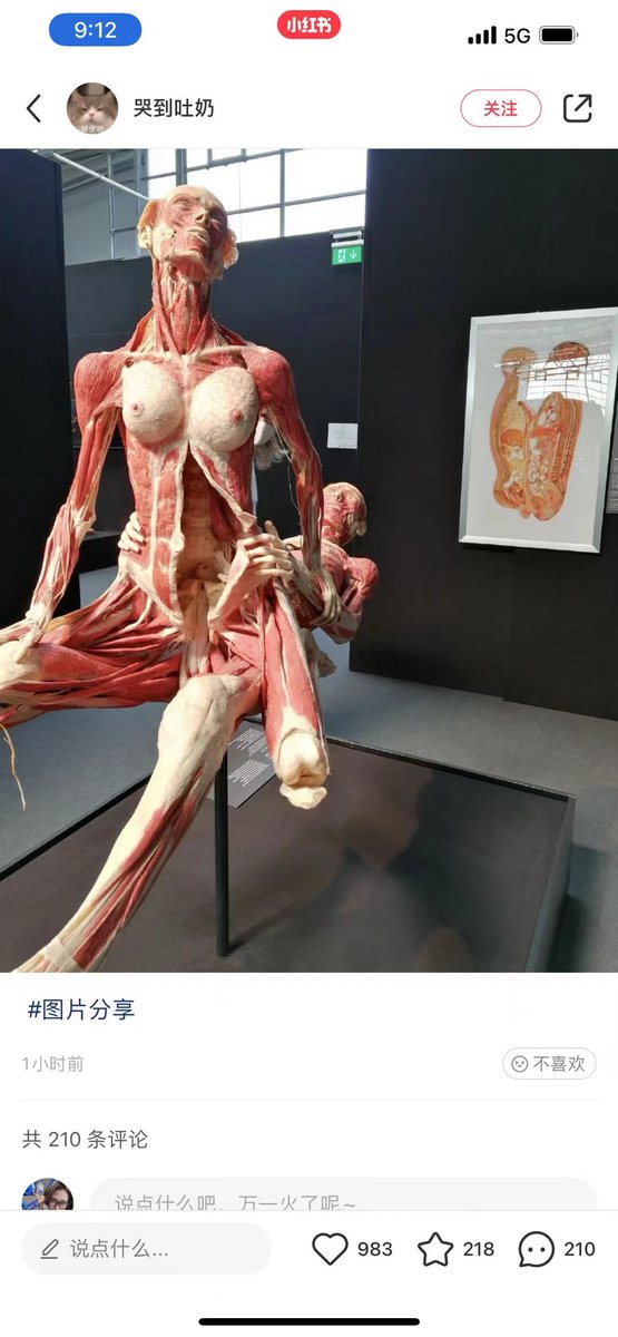 现在的解剖图都这样了😂
不过这个姿势挺深的☺️