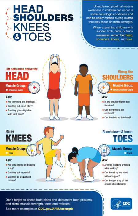 NOW is the time for heightened awareness to be on the lookout for cases of acute flaccid myelitis in patients presenting with weakness: reports of widespread enterovirus D68 circulation across the US + Europe, and polio recently detected in NY and UK.
THINK AFM