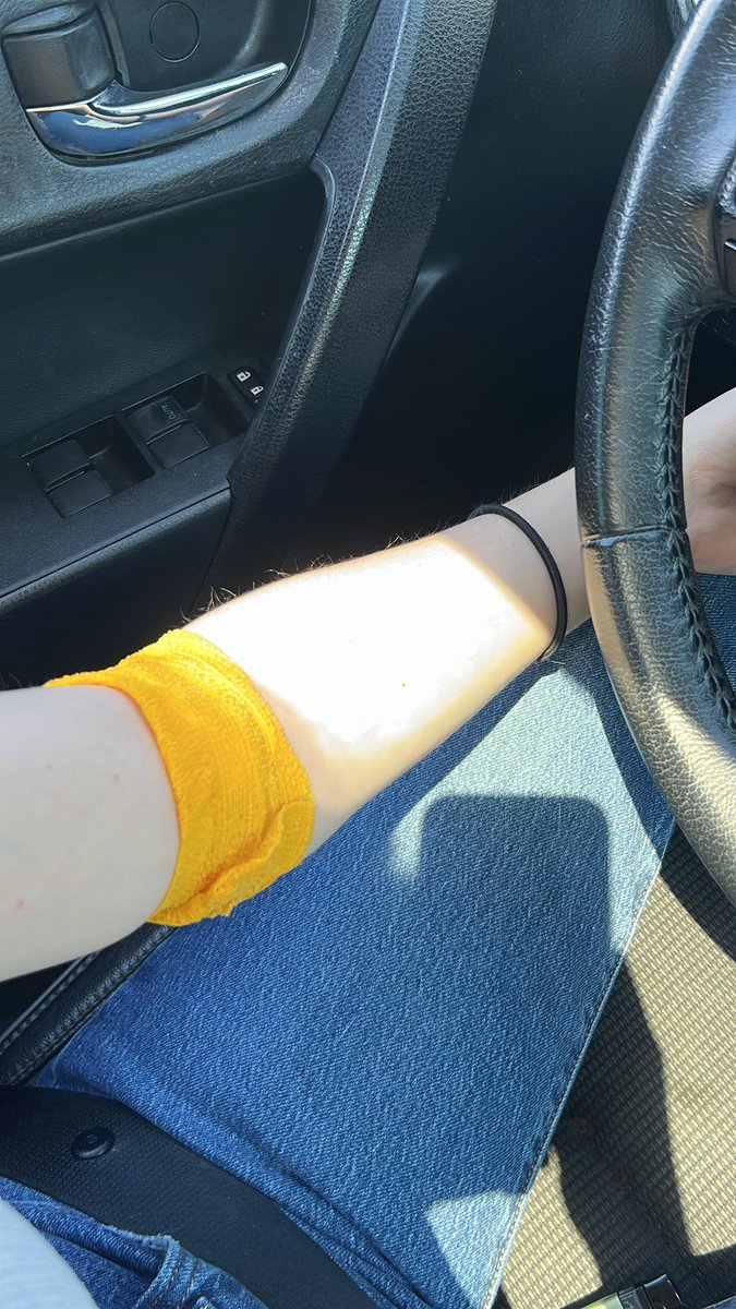 bellamarie441's tweet photo. @shortweirdbitch No video but here’s my battle scar https://t.co/ohY2OY3Pqf