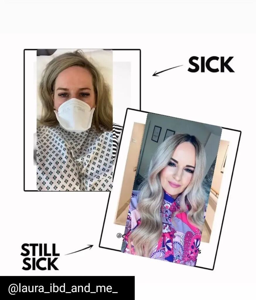 IBDSuperHeroes's tweet photo. IBDSuperHeroes shares 💜
Reposted from @laura_ibd_and_me_ ….
I.B.D
💜Invisible to others 💜
💜Visible to you 💜
Perception is tricky …
#ibd #ulcerativecolitis #colitiswarrior #crohnsandcolitis #ibdwarrior #crohnsandcolitisireland #ibdsuperheroes … https://t.co/xpRlyQ58kG https://t.co/T43AwEJVVz